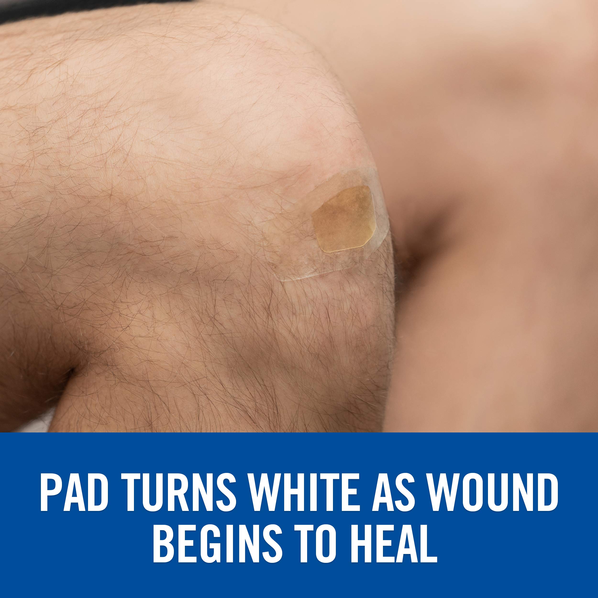 Nexcare Advanced Healing Hydrocolloid Pads, Gel Pad Helps Reduce Pain and Absorb Wound Fluids, Stretchy Wound Dressing Sticks to Damp Skin - 6 Pads - Image 7