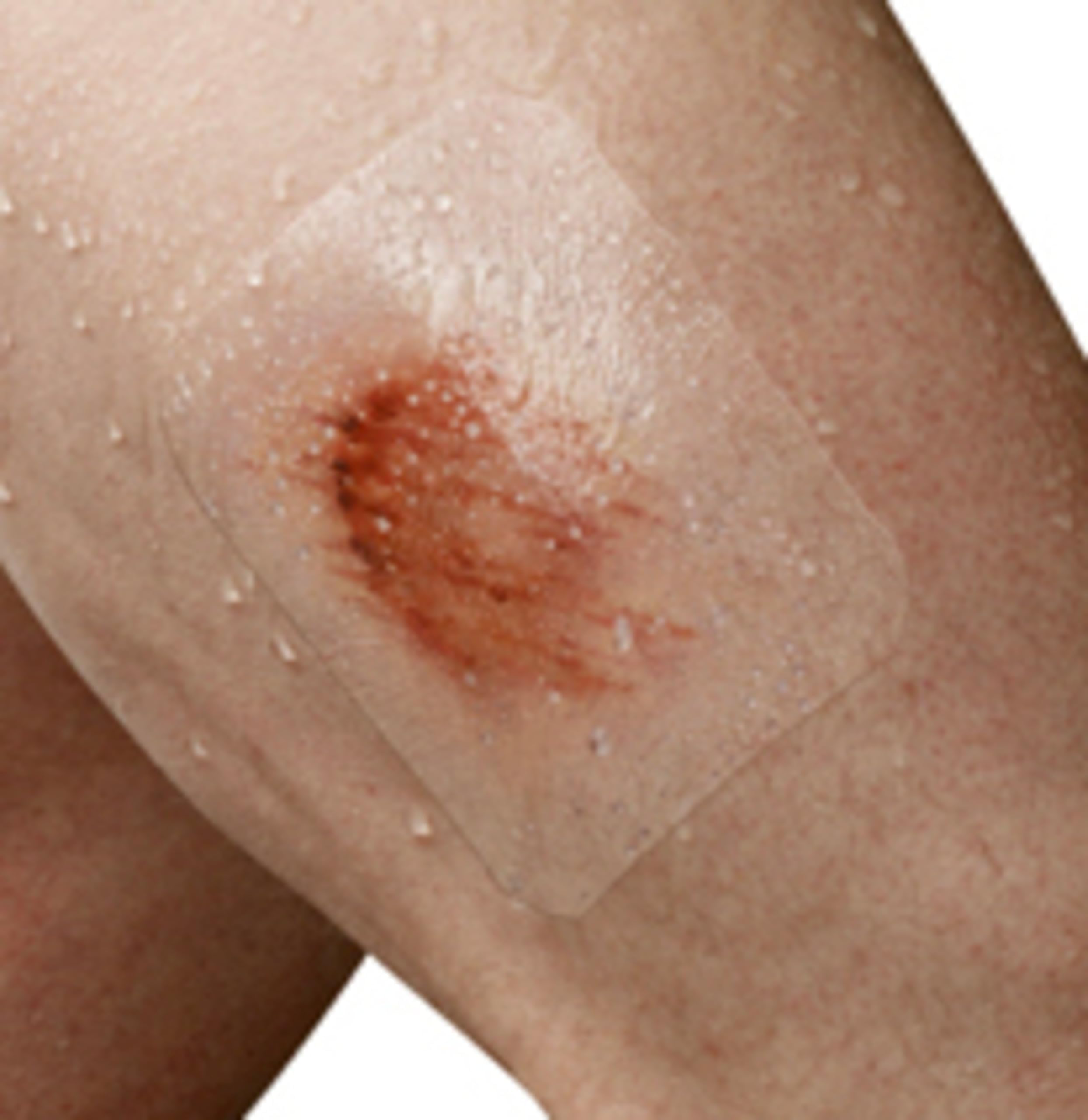 Nexcare Tegaderm Waterproof Transparent Dressing 4″ x 4¾″ – 4 Count Film Bandage for Wound Care, Seals Out Water, Dirt & Germs, Stays on Up to 7 Days - Image 12